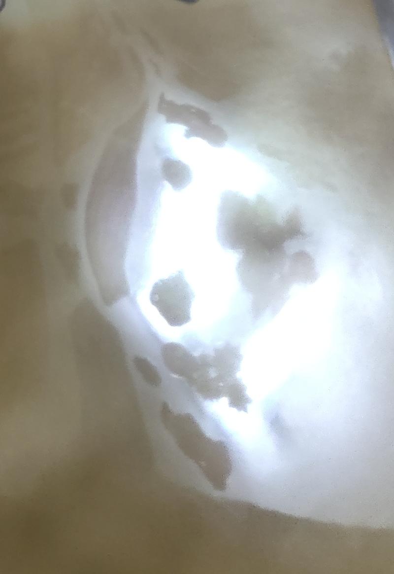 光的影子💡